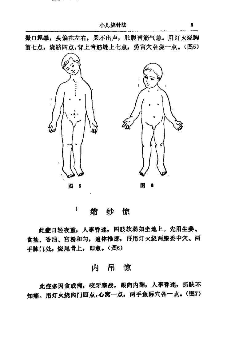 [小儿烧针法].王君萃.扫描版.pdf 第4页