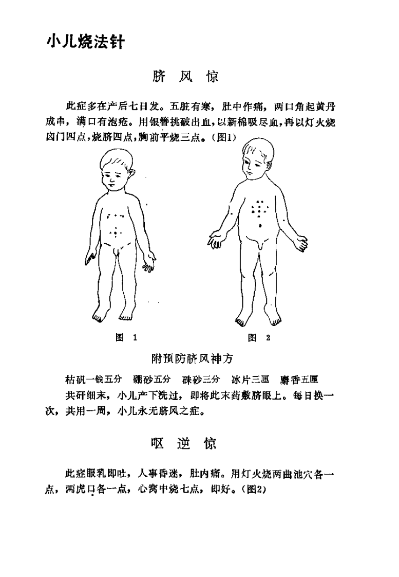 [小儿烧针法].王君萃.扫描版.pdf 第2页