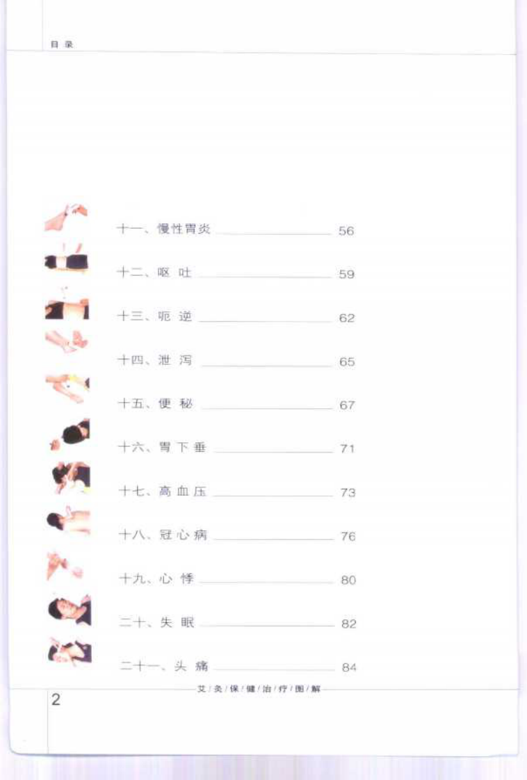 [艾灸保健治疗图解].孙永显.于善良.朱人杰.刘意.清晰扫描版.pdf 第3页