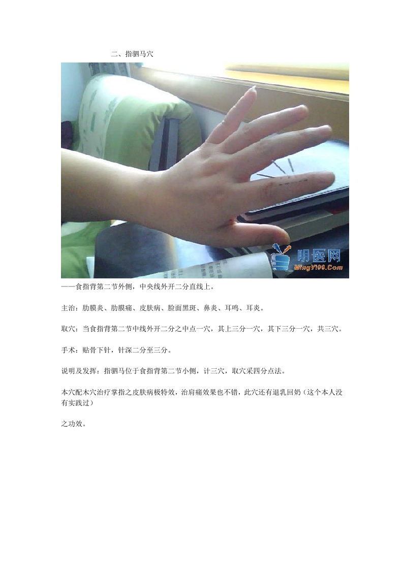 董氏奇穴真人扎针配图.doc 第2页