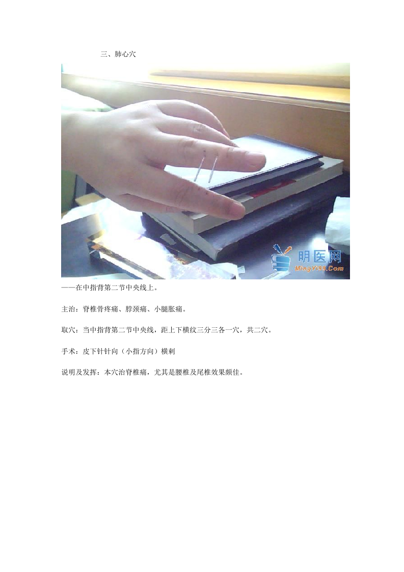 董氏奇穴真人扎针配图.doc 第3页