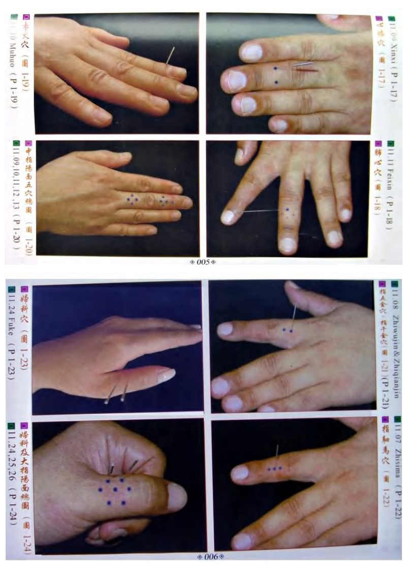 董氏奇穴真人穴位图.pdf 第3页