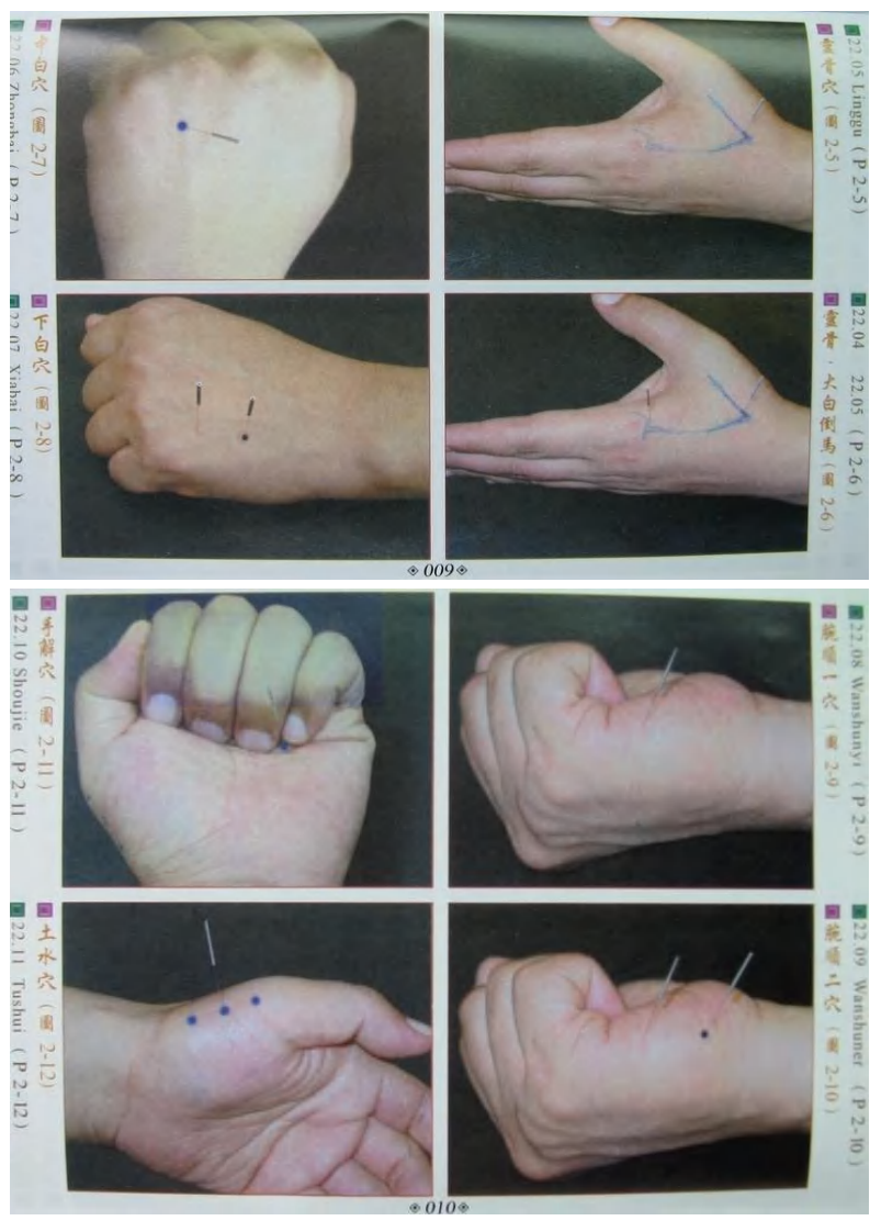 董氏奇穴真人穴位图.pdf 第5页