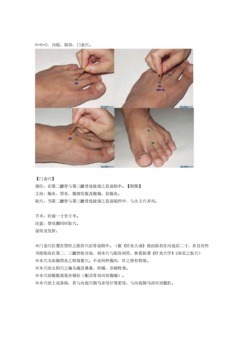 童氏奇穴发挥整理6-6.pdf 第4页