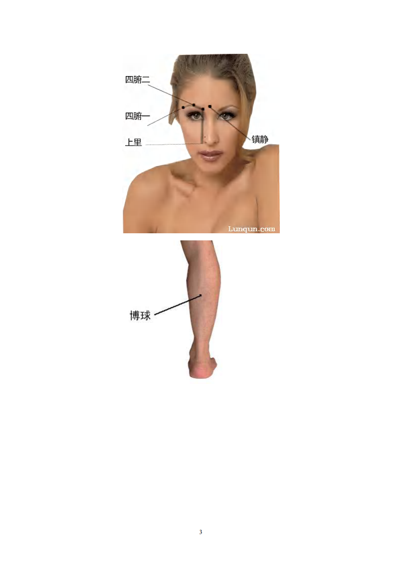 中国景昌特效针灸临床精要彩图.pdf 第4页
