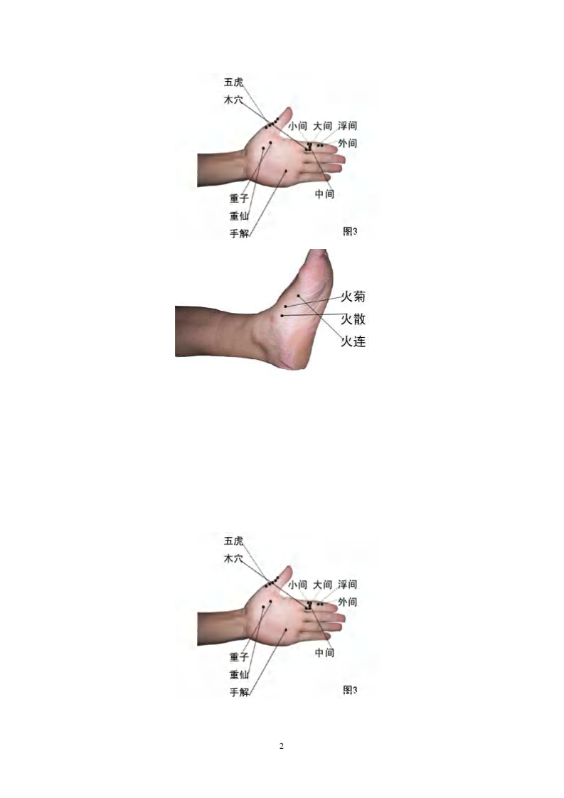 中国景昌特效针灸临床精要彩图.pdf 第3页