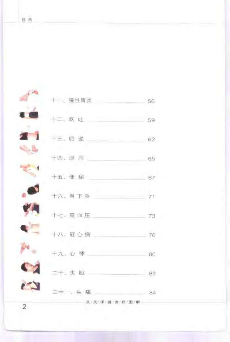 [艾灸保健治疗图解].孙永显等.扫描版.pdf 第3页