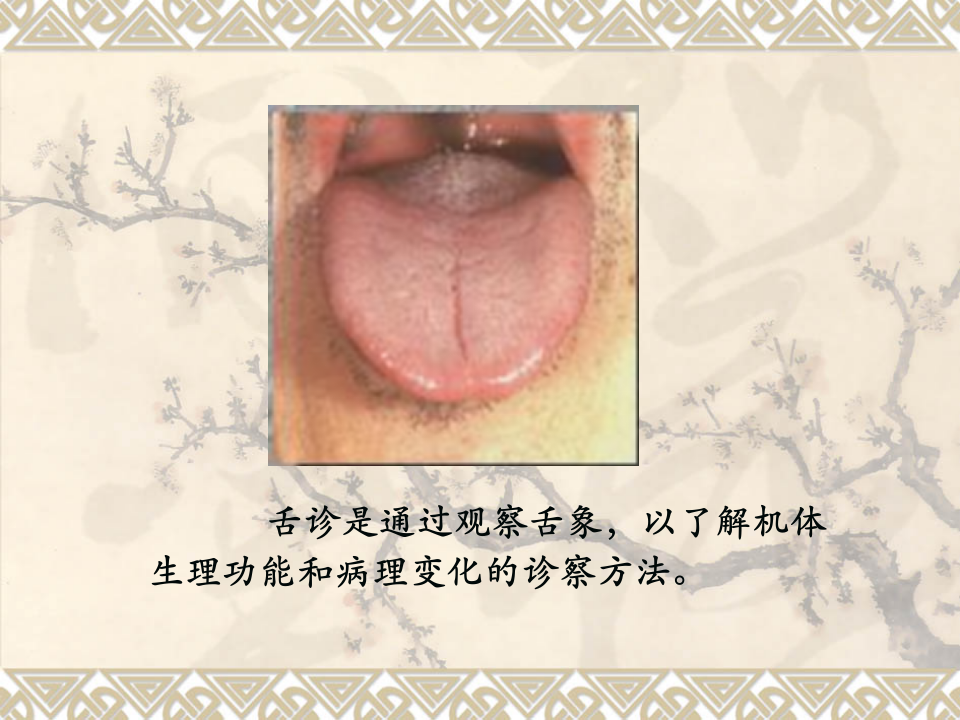 舌__诊.ppt 第2页