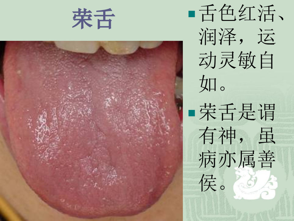 舌诊图片.ppt 第3页
