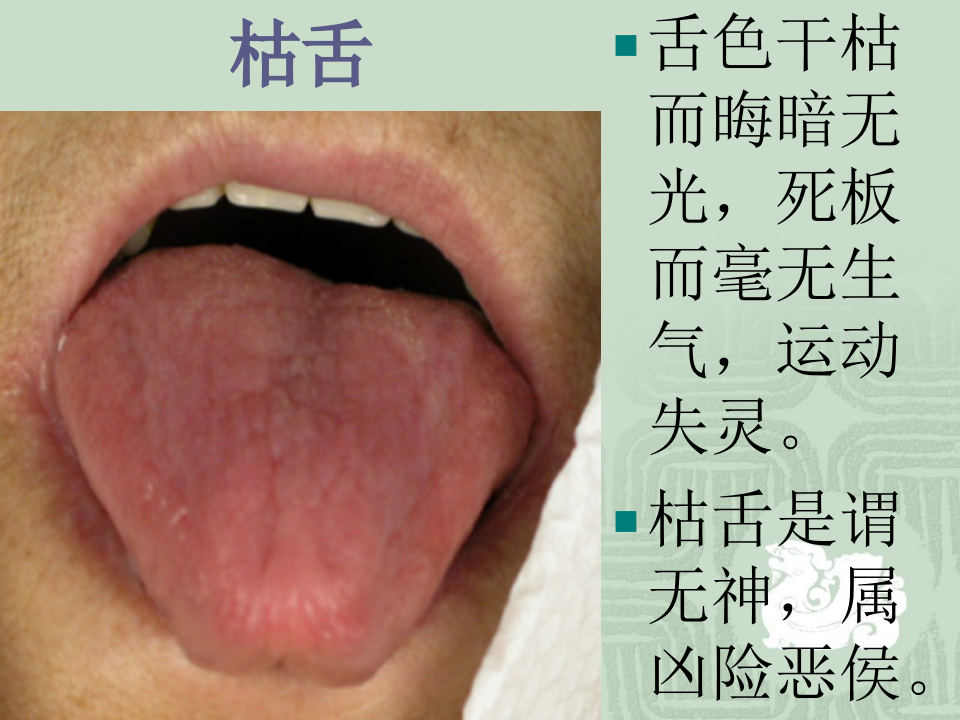 舌诊图片.ppt 第4页