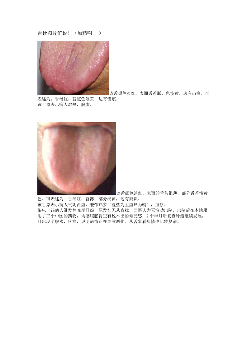 舌诊图谱.doc 第1页