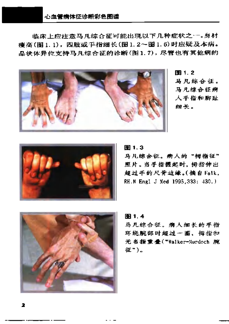 心血管病征诊断彩色图谱..pdf 第3页