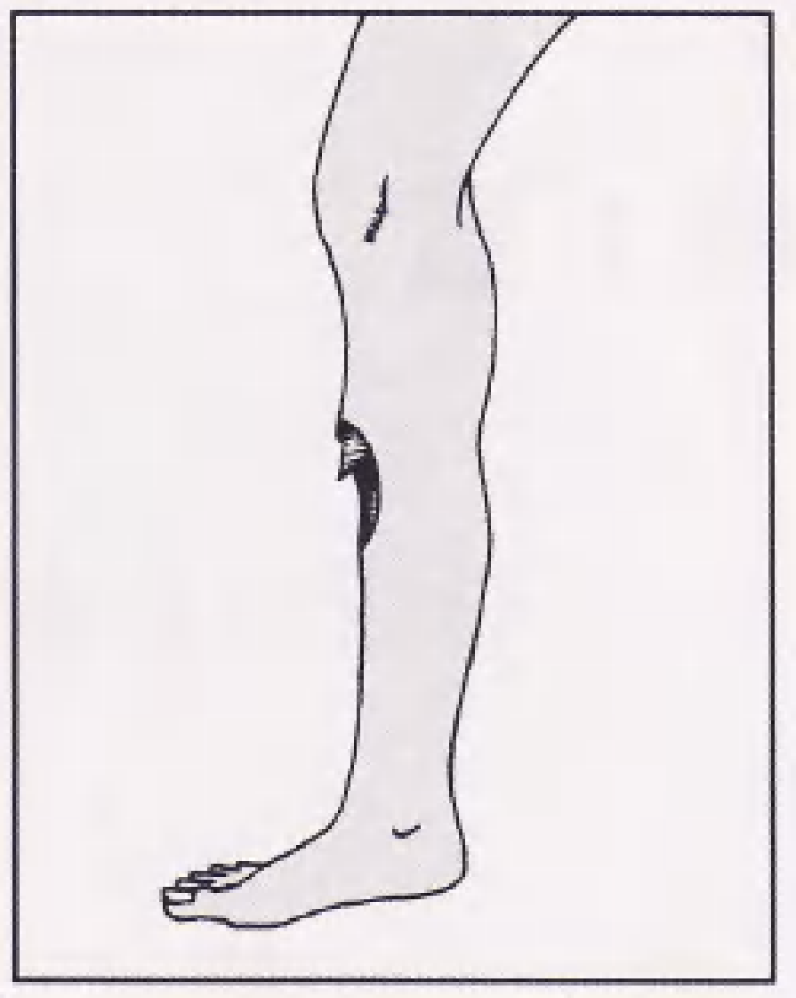 实用骨折治疗学（美）（全图版）.pdf 第2页