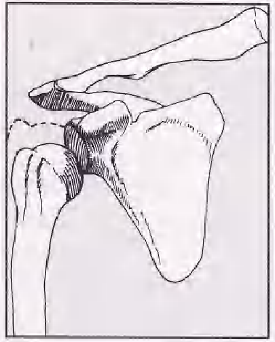 实用骨折治疗学（美）（全图版）.pdf 第5页