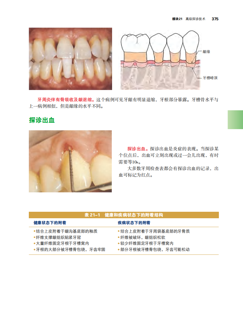 第五部分 高级刮治技巧.pdf 第5页