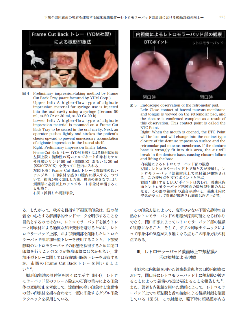 下颌吸着式义齿的制作.pdf 第4页