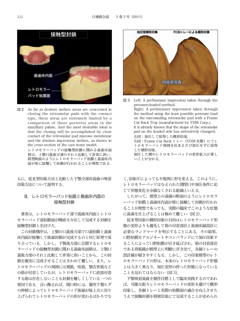 下颌吸着式义齿的制作.pdf 第3页