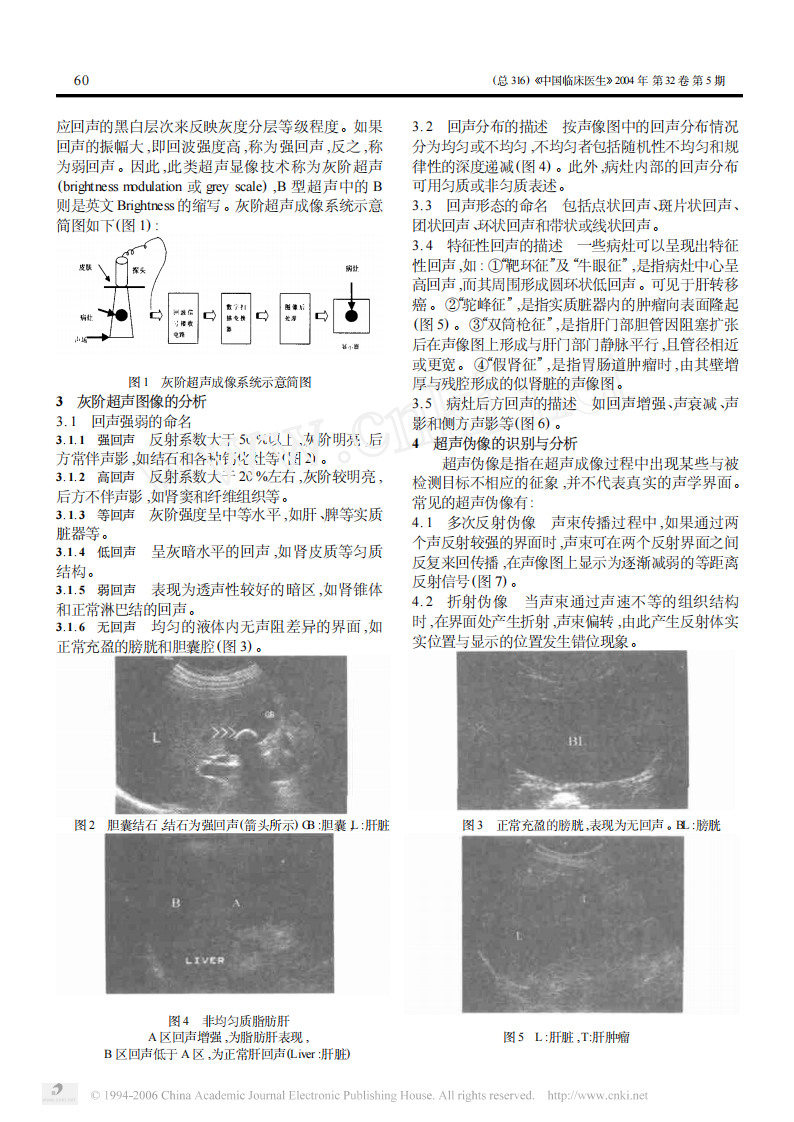 临床医生学超声第1讲超声诊断仪的成像原理和声像图分析.pdf 第2页