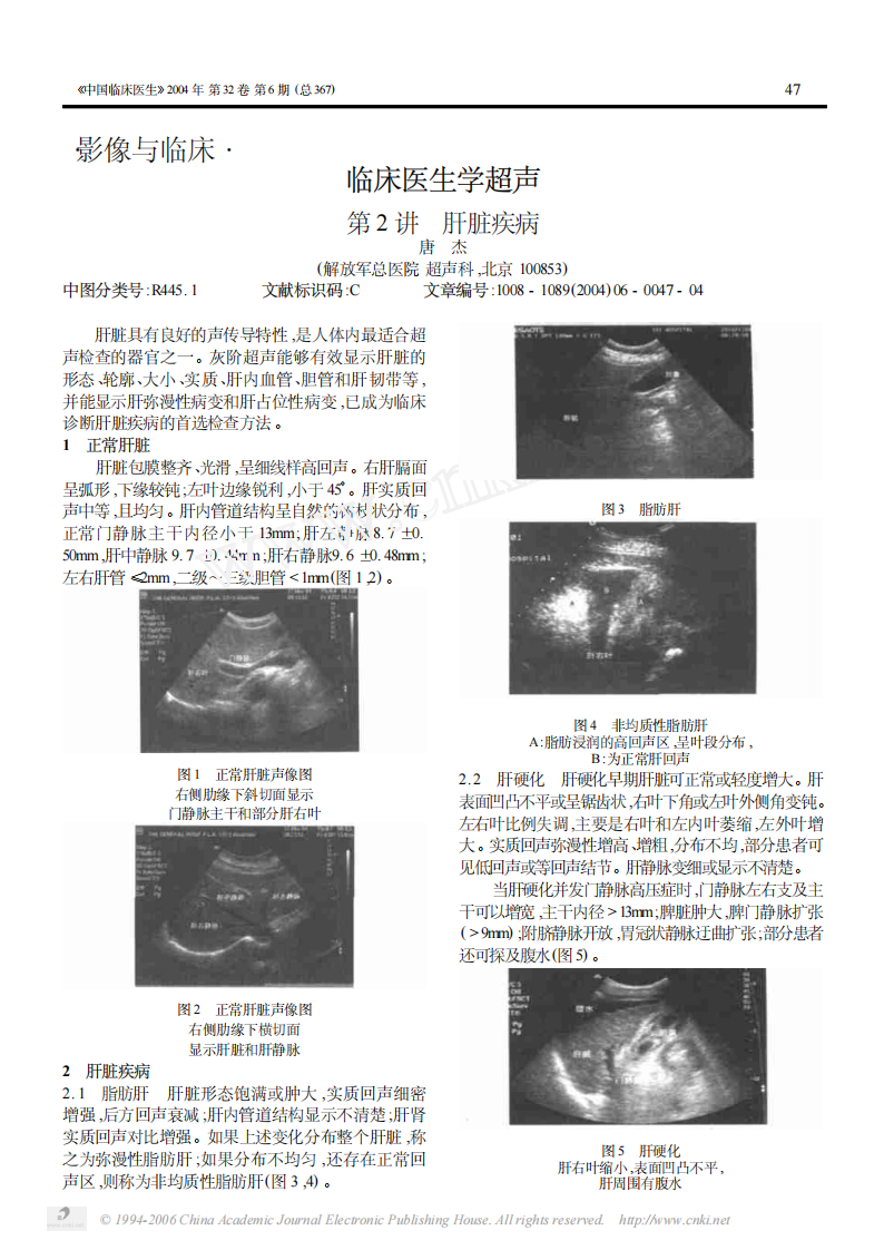 临床医生学超声第2讲肝脏疾病.pdf 第1页