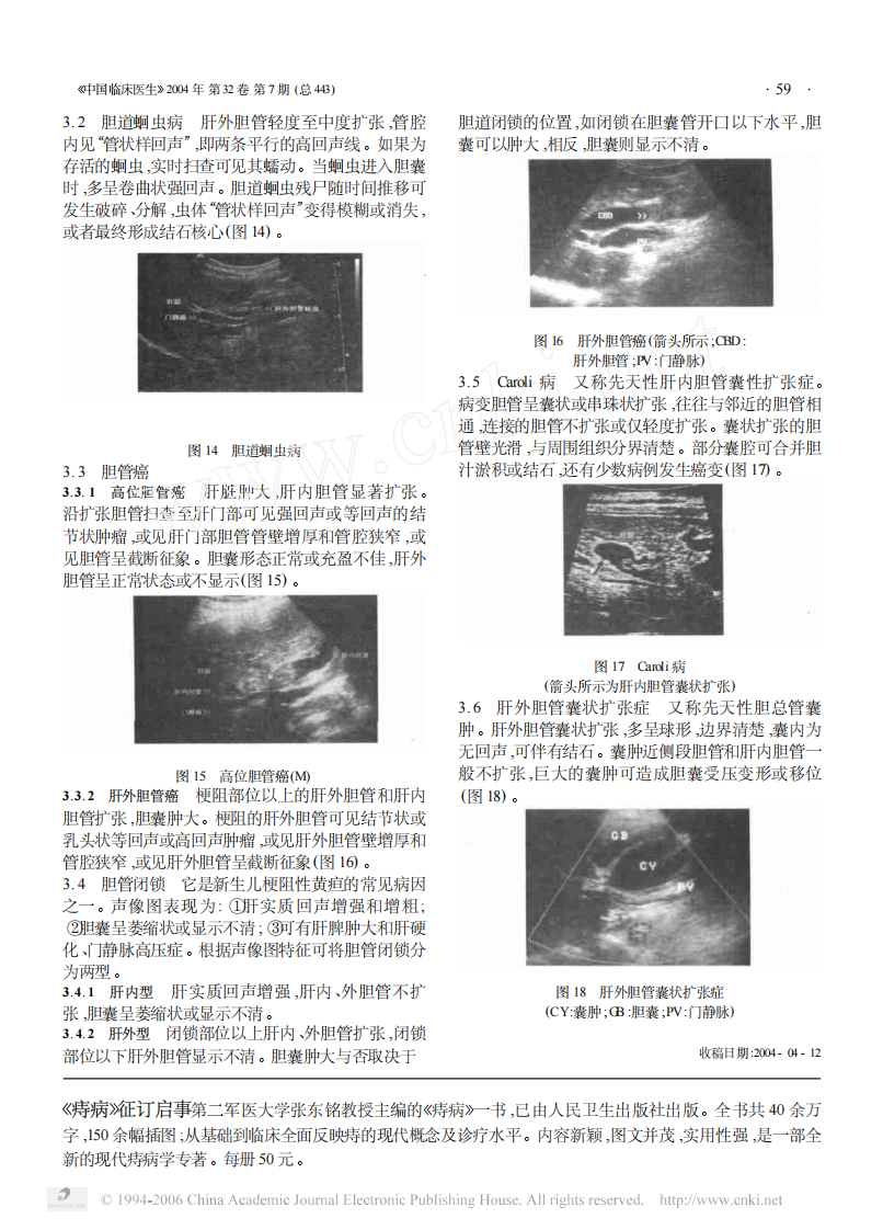 临床医生学超声第3讲胆道系统疾病.pdf 第4页