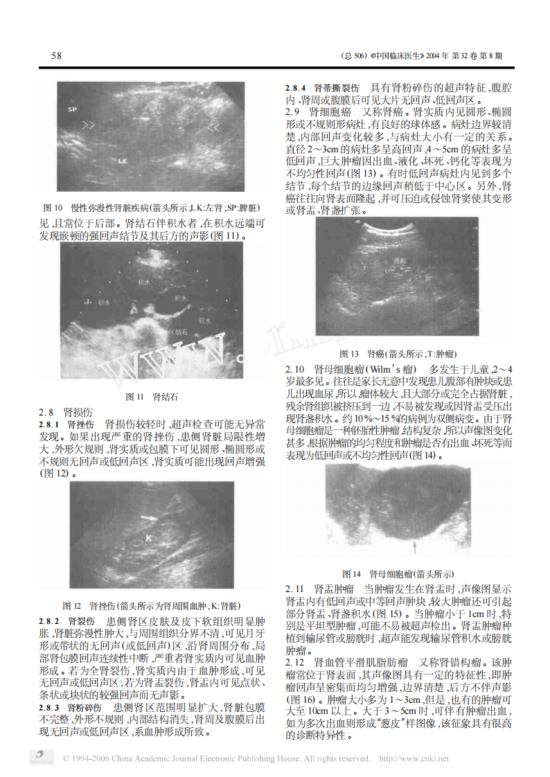 临床医生学超声第4讲肾脏输尿管疾病.pdf 第3页