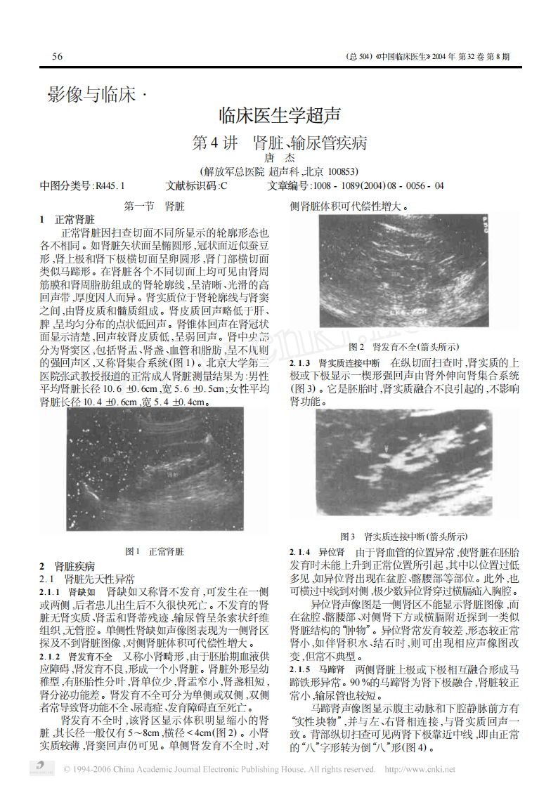 临床医生学超声第4讲肾脏输尿管疾病.pdf 第1页