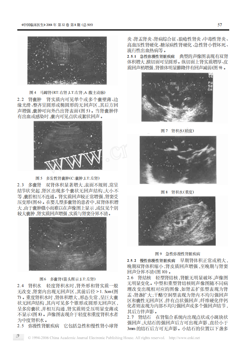 临床医生学超声第4讲肾脏输尿管疾病.pdf 第2页