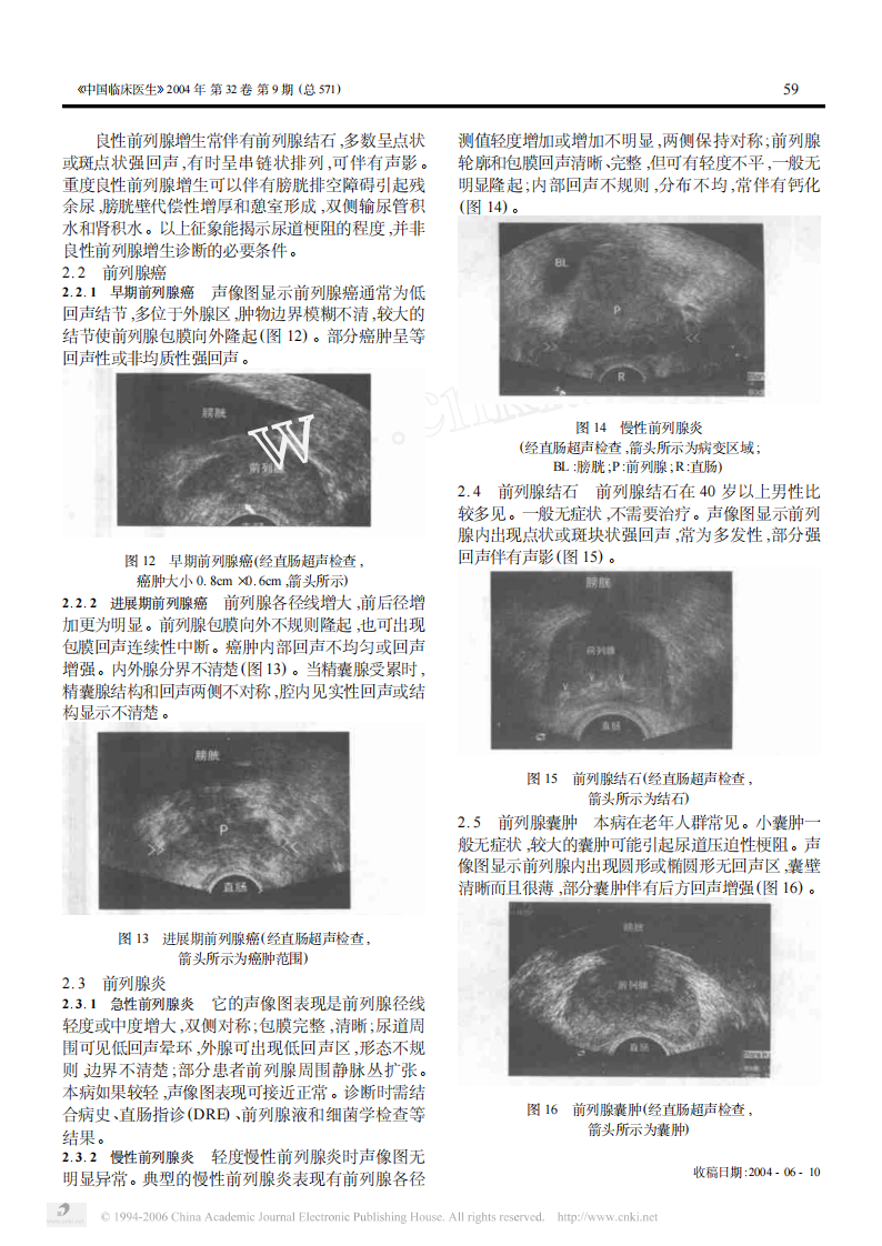 临床医生学超声第5讲膀胱前列腺疾病.pdf 第4页