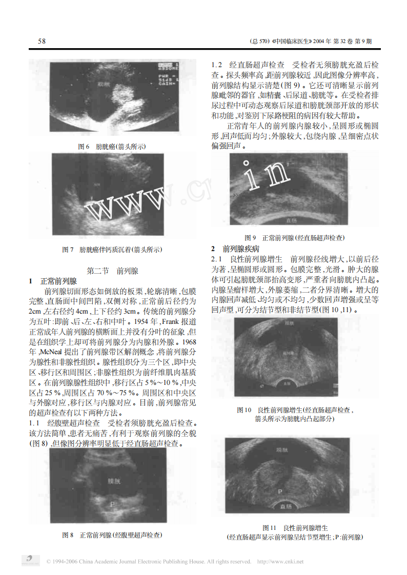 临床医生学超声第5讲膀胱前列腺疾病.pdf 第3页