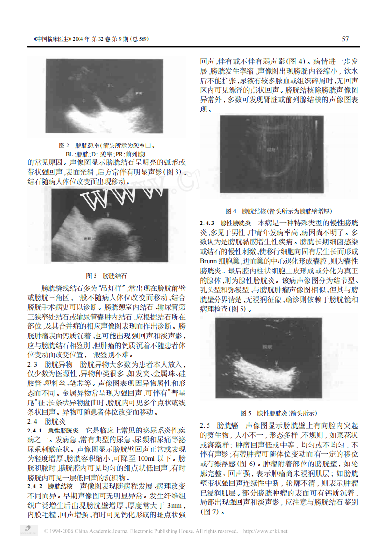 临床医生学超声第5讲膀胱前列腺疾病.pdf 第2页