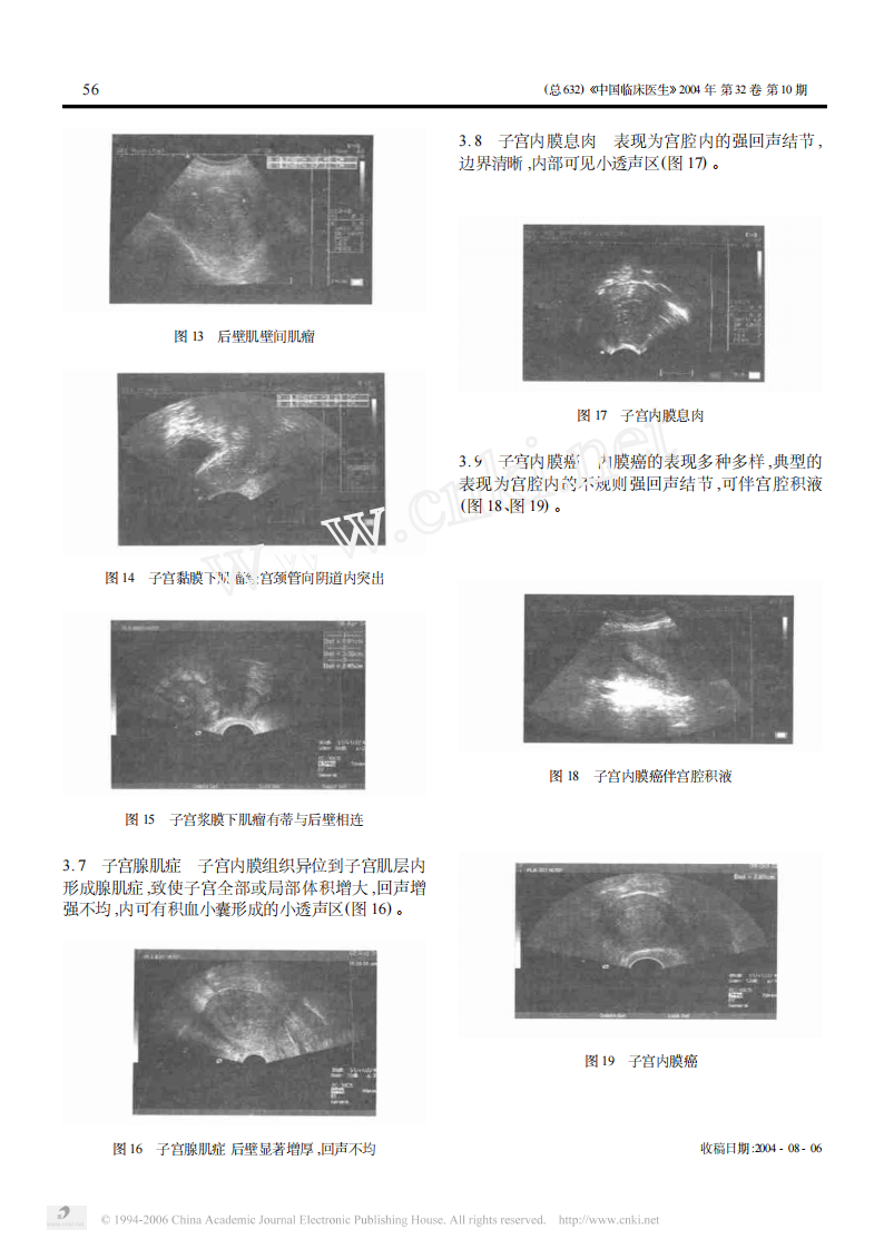 临床医生学超声第6讲子宫疾病.pdf 第3页