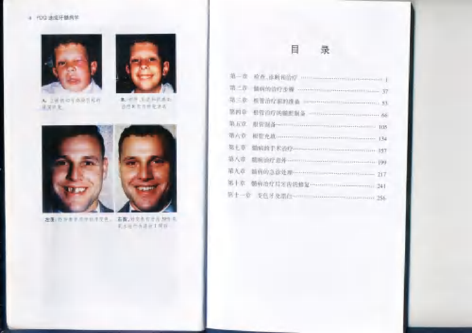 PDQ速成牙髓病学.pdf 第1页