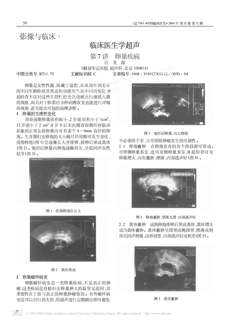 临床医生学超声第7讲卵巢疾病.pdf 第1页