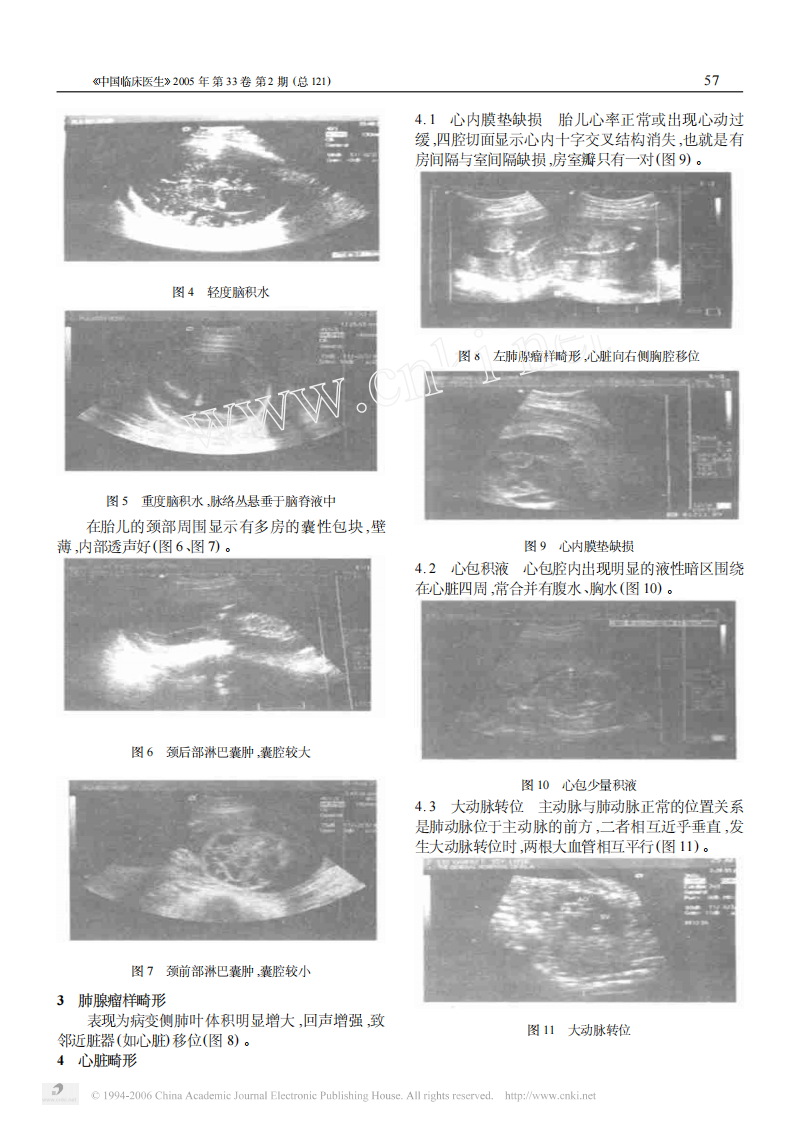 临床医生学超声第8讲胎儿畸形.pdf 第2页