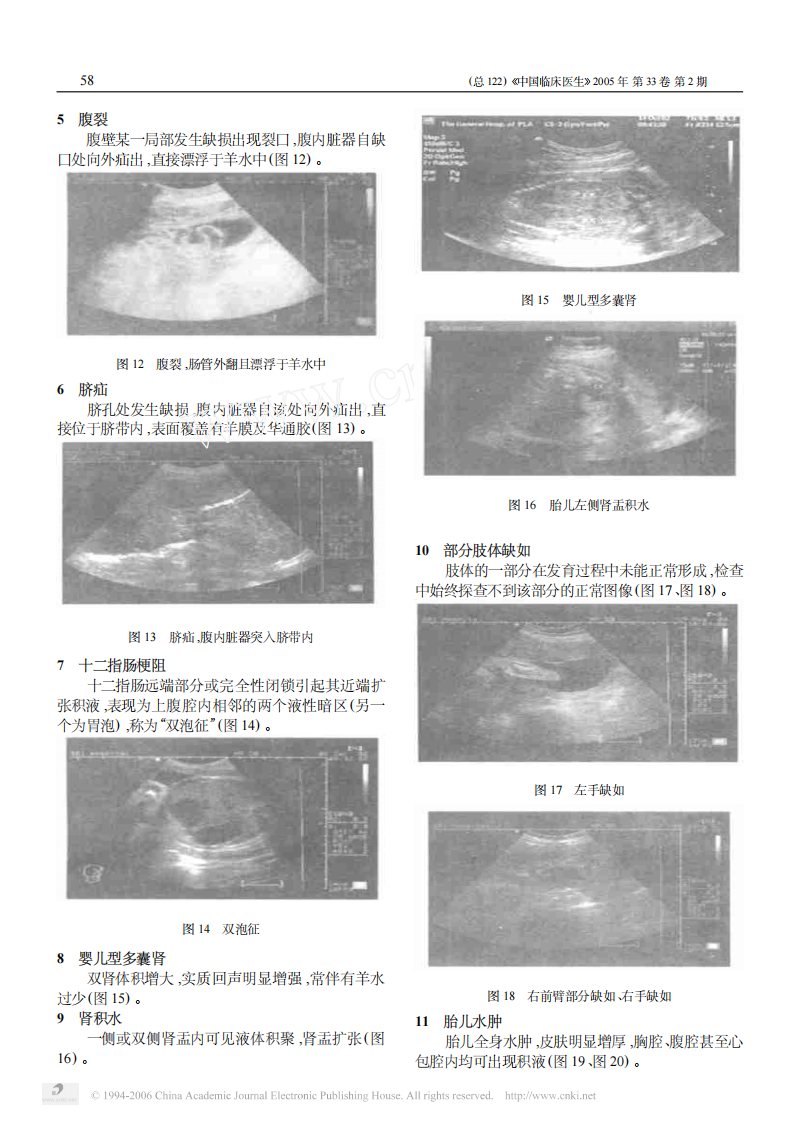 临床医生学超声第8讲胎儿畸形.pdf 第3页
