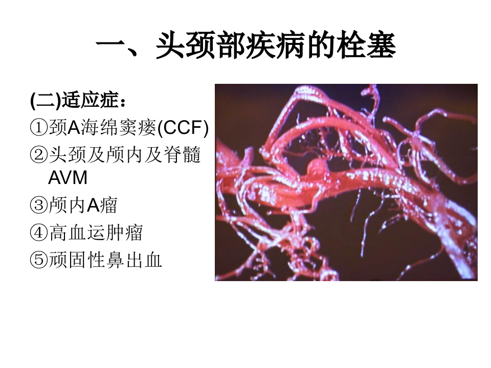 04-05 介入性神经放射学.ppt 第3页