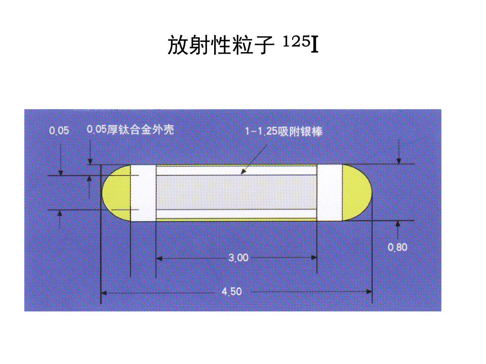 04-05 消化系介入放射学讲义.ppt 第5页