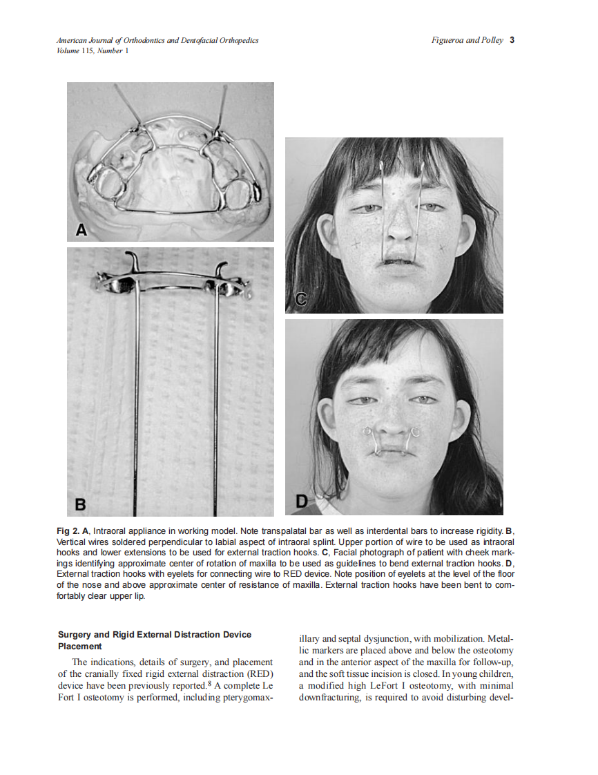 1999_115_1_1_12_Figueroa.pdf 第3页