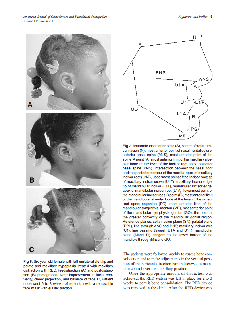 1999_115_1_1_12_Figueroa.pdf 第5页