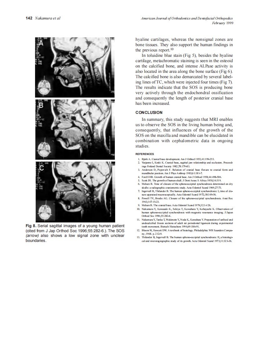 1999_115_2_138_142_Nakamura.pdf 第5页