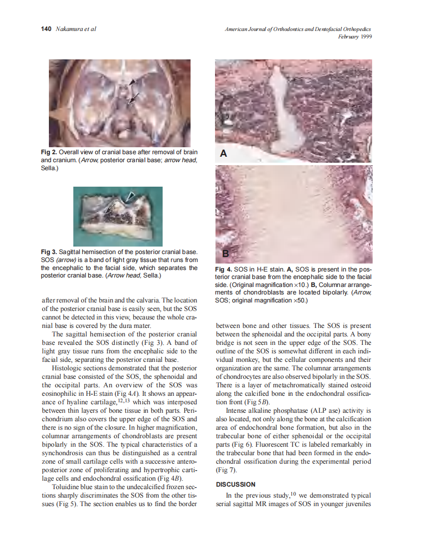 1999_115_2_138_142_Nakamura.pdf 第3页