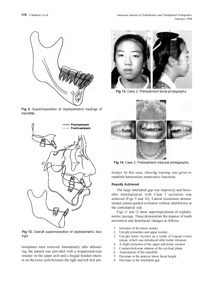 1999_115_2_166_174_Umemori.pdf 第5页