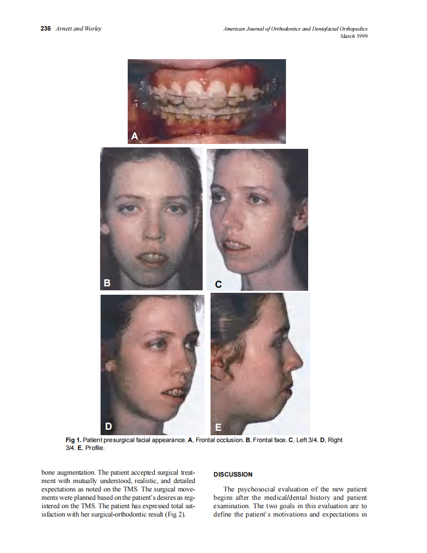 1999_115_3_233_238_Arnett.pdf 第4页