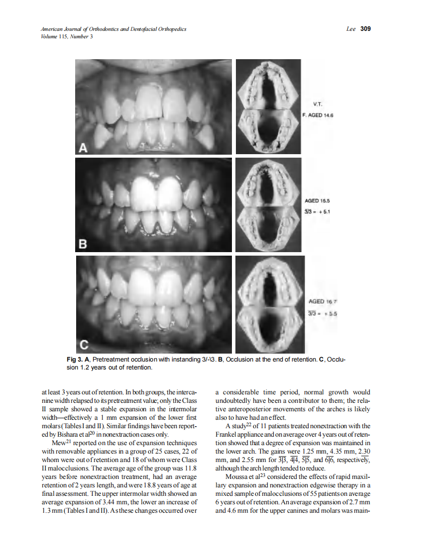 1999_115_3_305_313_Lee.pdf 第5页