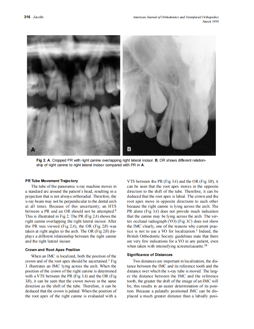 1999_115_3_314_322_Jacobs.pdf 第3页