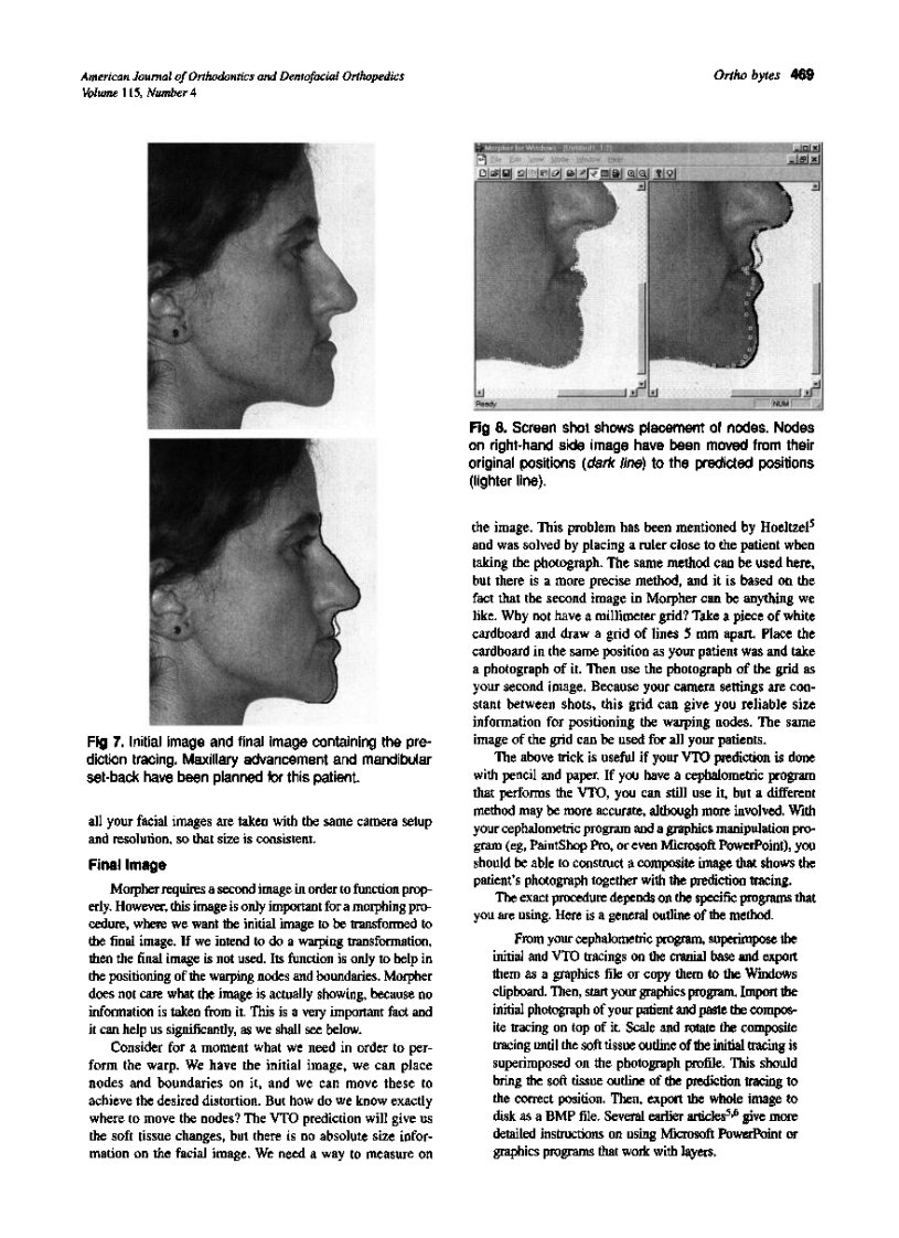1999_115_4_466_470_Halazonetis.pdf 第4页