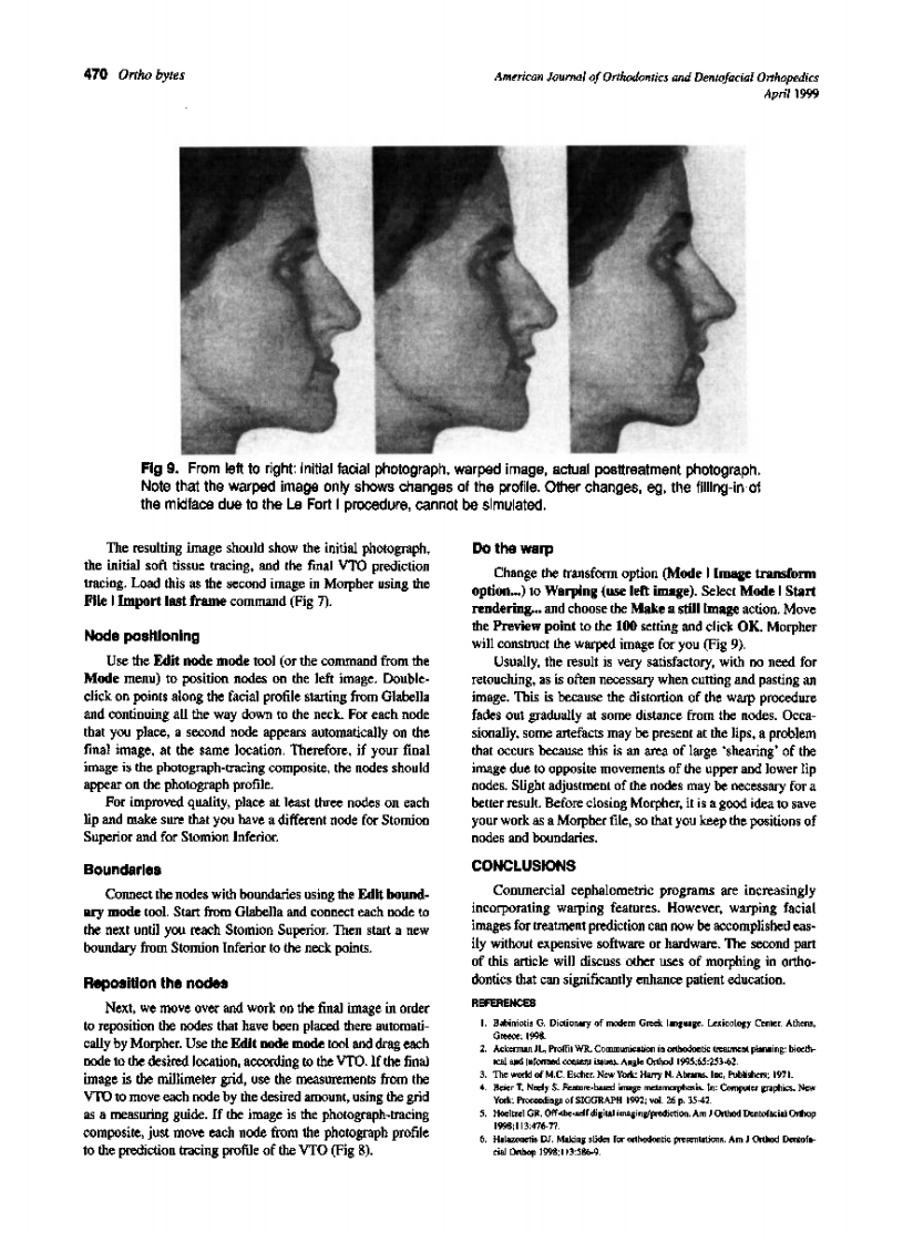 1999_115_4_466_470_Halazonetis.pdf 第5页