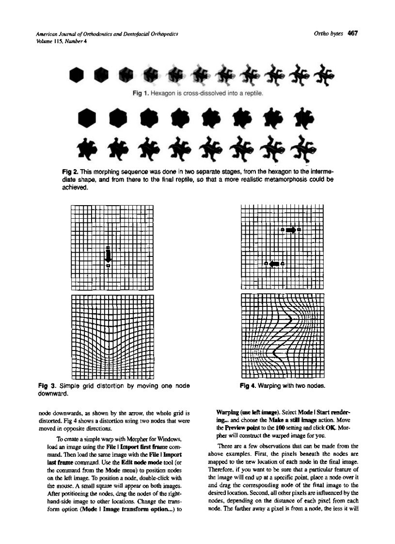 1999_115_4_466_470_Halazonetis.pdf 第2页