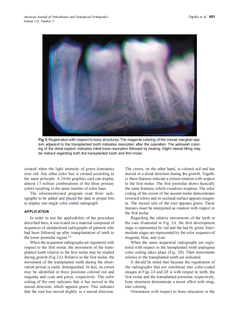 1999_115_5_03.pdf 第4页