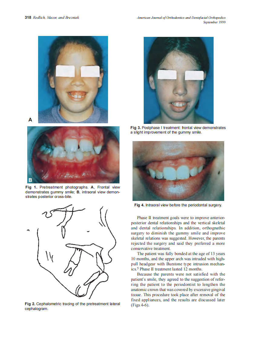 1999_116_3_317_320_Redlich_by_OrTHoTaMiNe.pdf 第2页